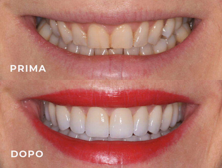 Estetica dentale, avere un sorriso bello e sano fa la differenza